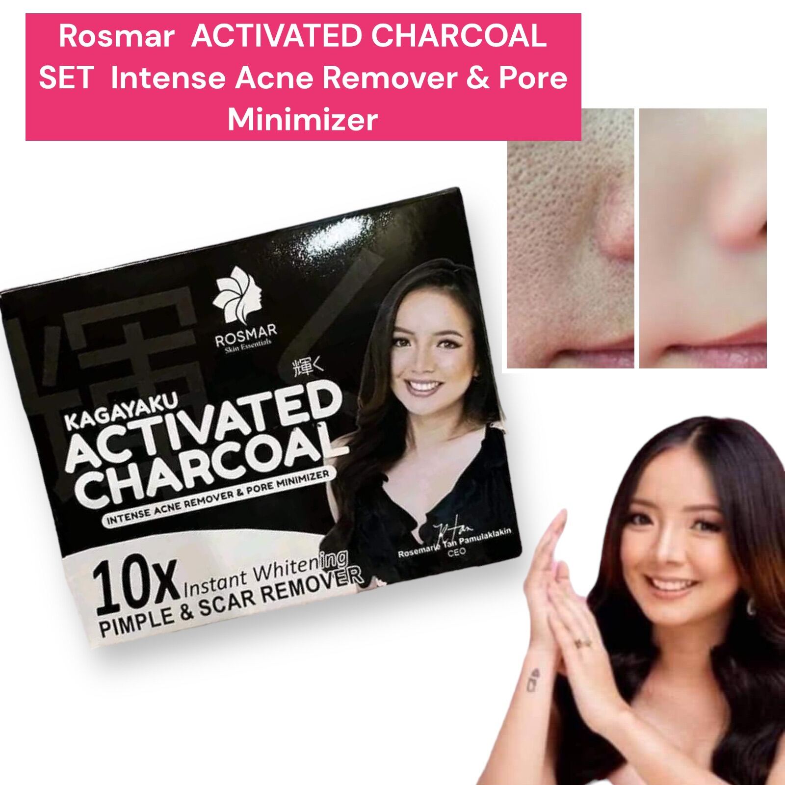 Rosmar Kagayaku ACTIVATED CHARCOAL SET Intense Acne Remover Pore