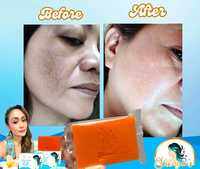 Shangme Organic Kojic Acid Niacinamide face and body family soap