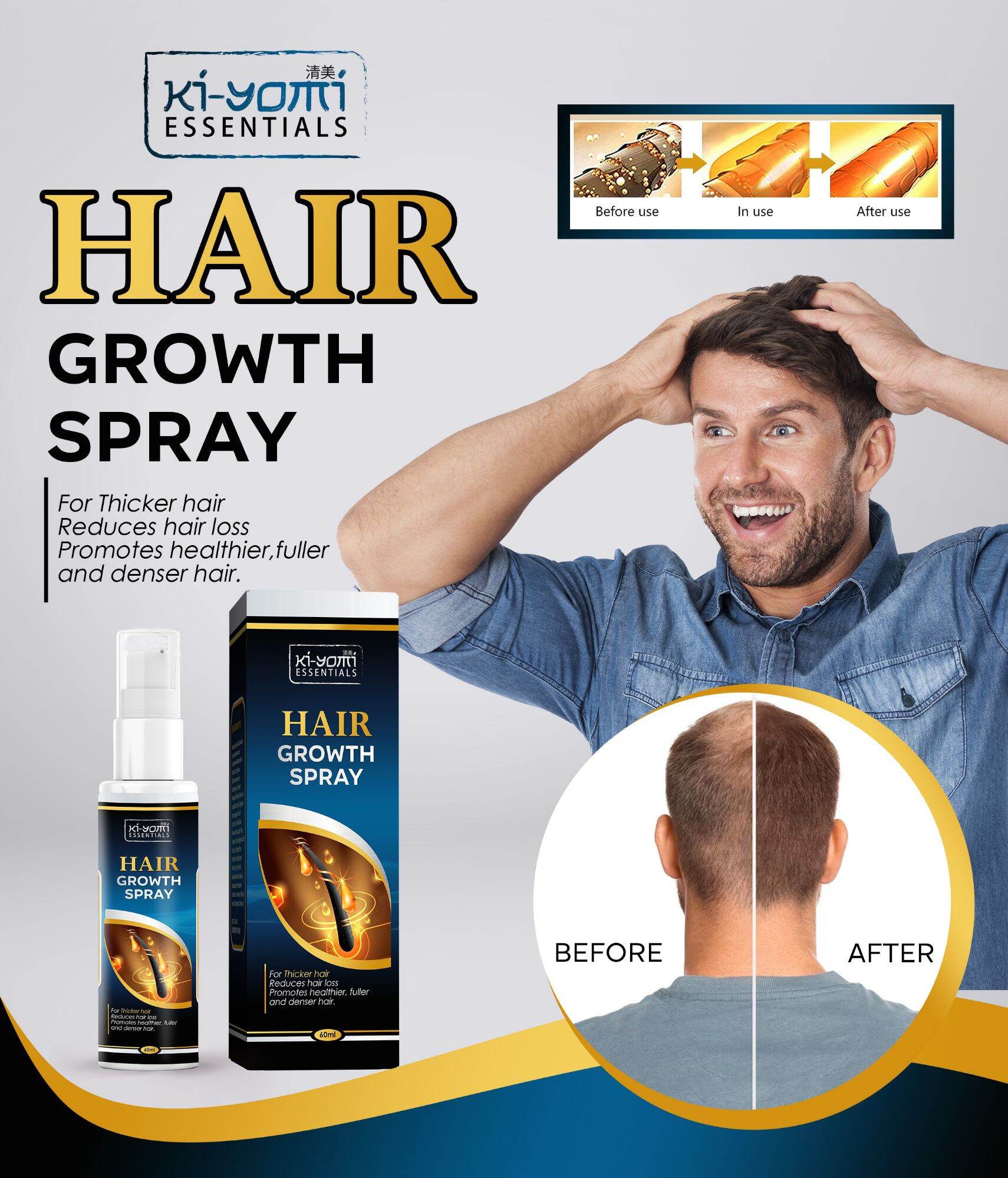 Hiar Growth spray hair grower | Lazada PH