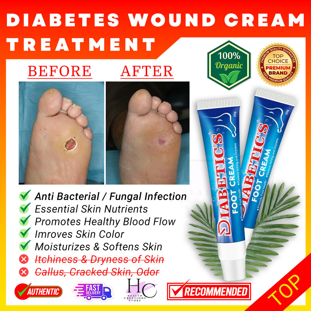 SUMIFUN Diabetes Wound Ointment Diabetic Wound Ointment Cream Diabetic Foot  Cream Wounds Healing Cream Wound Healing   Lazada PH