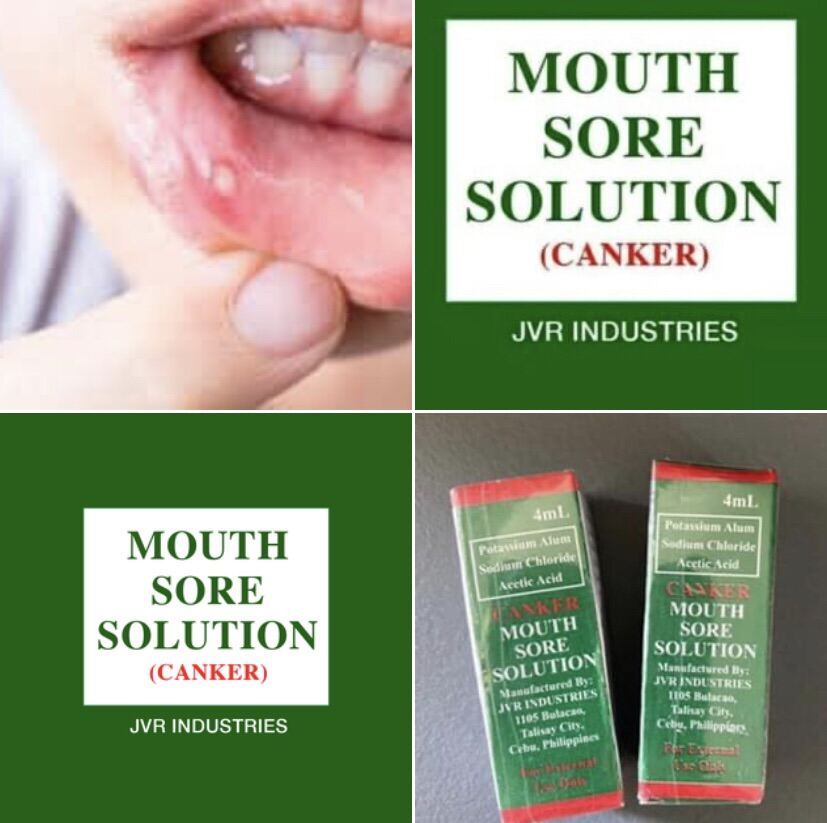 Effective mouth sore treatment tanggal singaw Lazada PH
