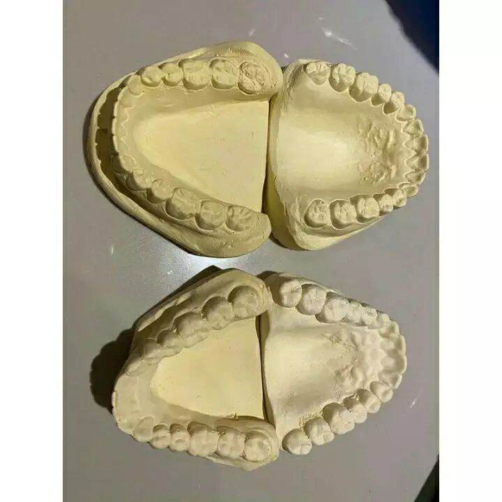 Dentolous Model Cast for student. 