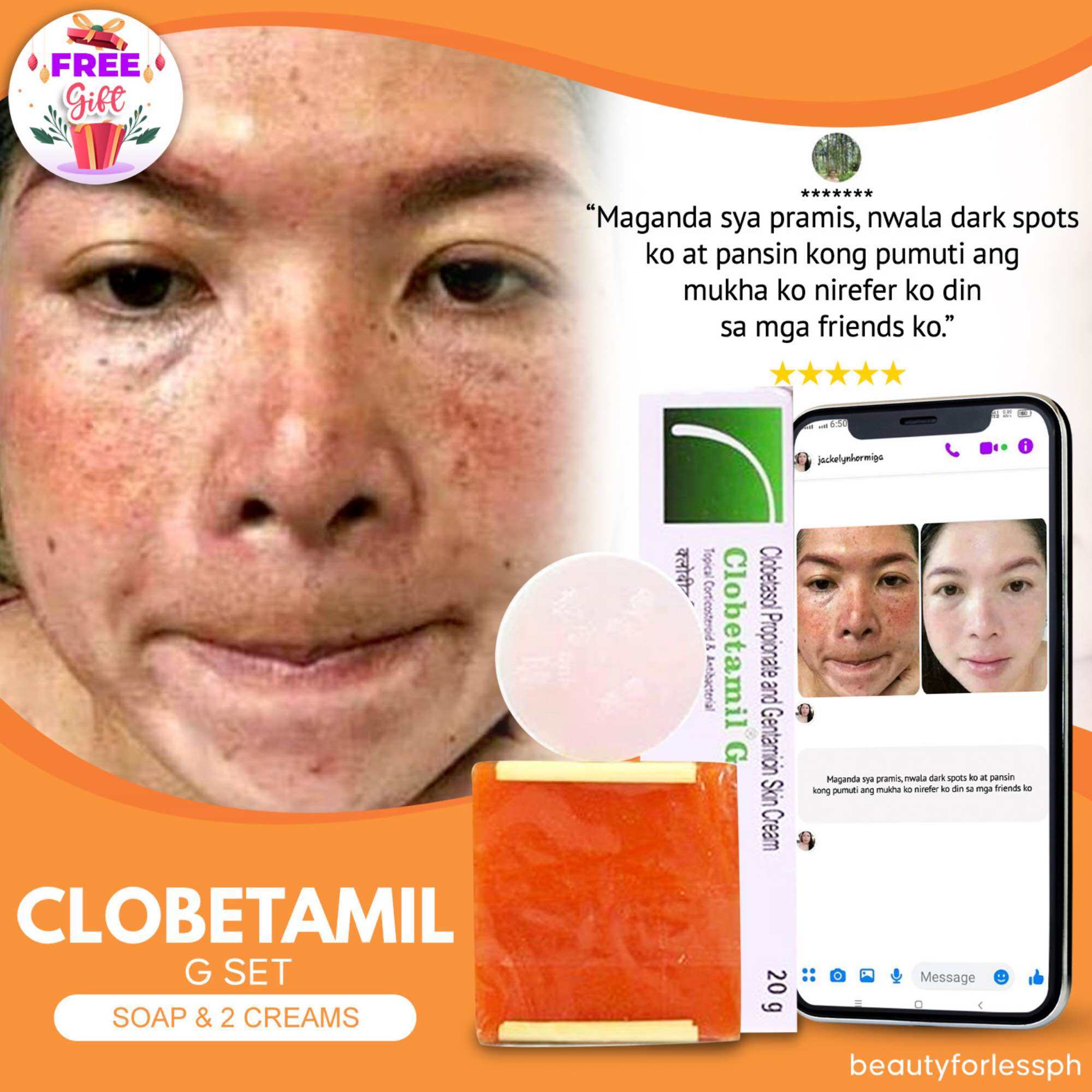 From Thailand! Klobetamil G Set highly effective Pekas, Melasma, Dark spots, Pimple remover set. Clobetamil G 7 days result.. 
