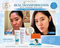 Shangme Skin Complete Care Set – Niacinamide Kojic Soap + Vitamin C Sunscreen Moisturizer + Lavender Collagen Peptide Lotion | Organic Skincare for Face & Body