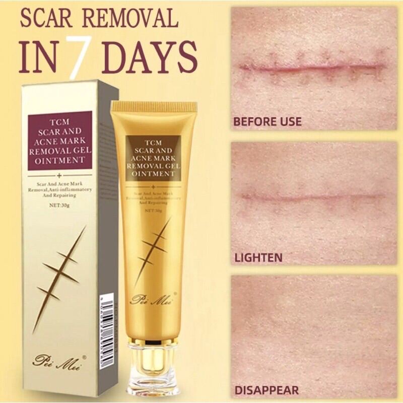 tcm-scar-and-acne-mark-removal-gel-ointment-lazada-ph