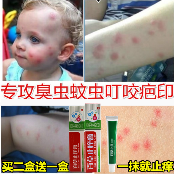 Flea Bite AntiItching Cream AntiRedness and Swelling Adult Children's