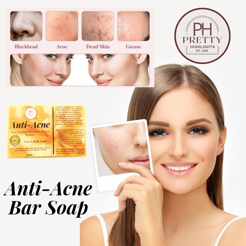 100g-anti-acne-bar-soap-for-deep-cleansing-lazada-ph