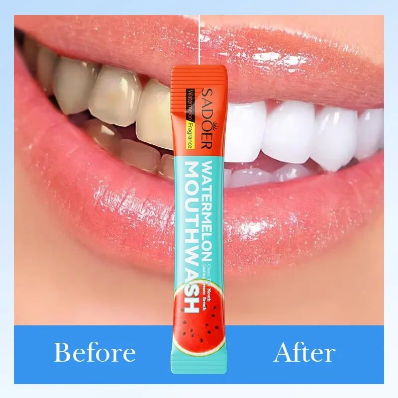 20pcs Mouthwash Teeth Whitening Guru Nanda Teeth Pulling Oil Watermelon Flavor Portable Mouth Wash Freshen Breath Clean Oral. 