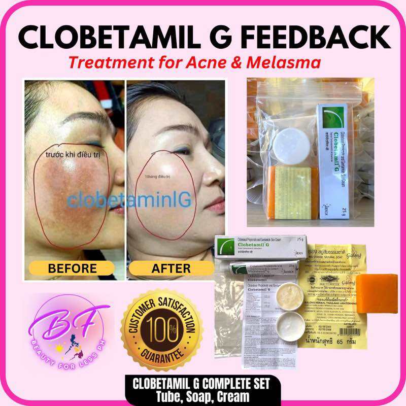 From Thailand! Klobetamil G Set highly effective Pekas, Melasma, Dark spots, Pimple remover set. Clobetamil G 7 days result.. 
