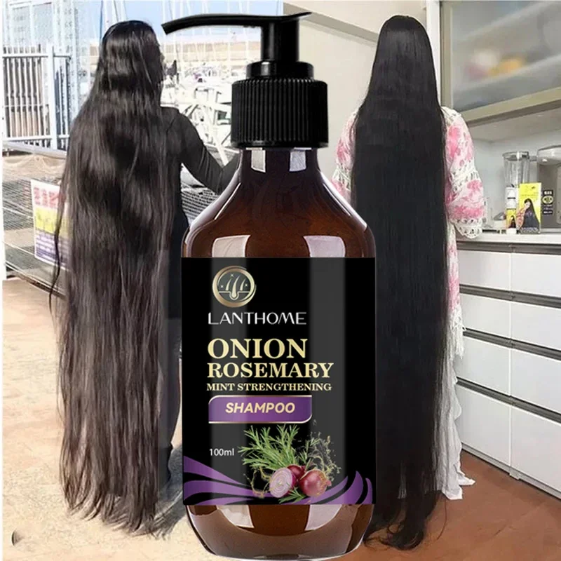 100ML Hair Shampoo For Fast Hair Growth Rosemary Onion Shampoo Spray Anti Hair Loss Effective Within 7 Day Hair Growth Product