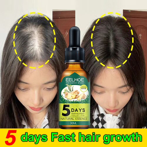 Fast Hair Growth Serum - 30ml - Prevents Baldness - Minoxidil - Cast