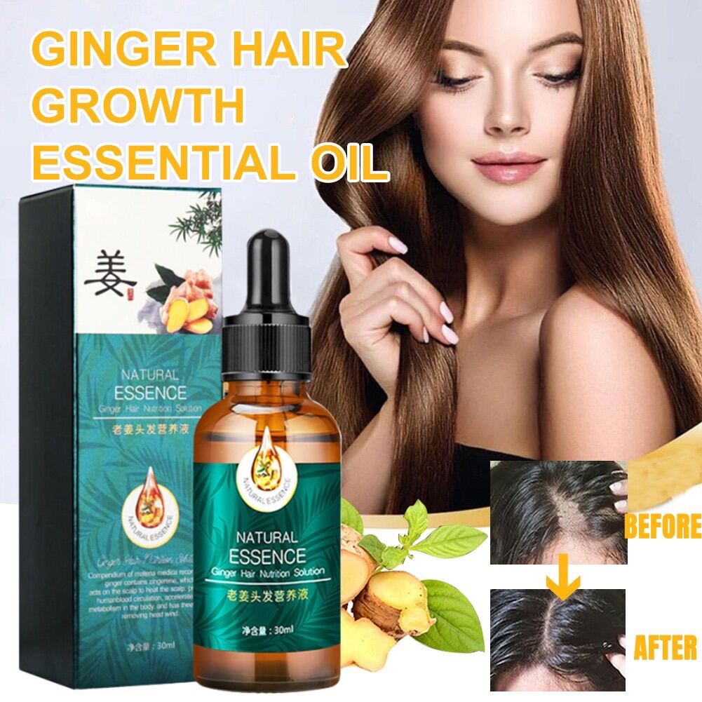 Minoxidil Fast Hair Growth Treatment Essence hair Serum Ginger ...