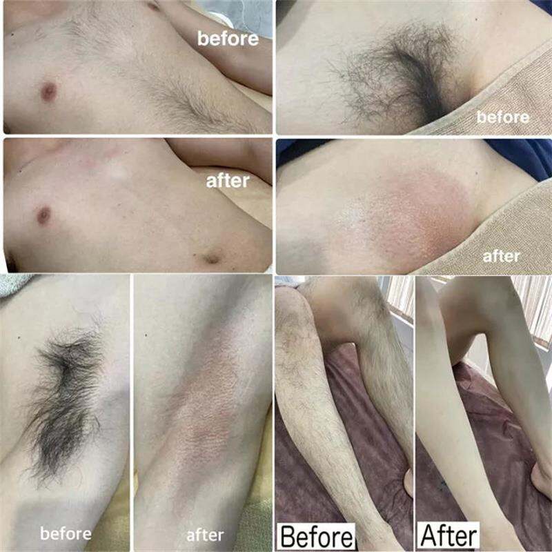 100ml Hair Removal Cream For Private Parts spray foam Hair Removal For Underarm Painless Hair Removal Cream Hair Remover For Vagina Fast Hair Removal For Whole Body Arms Thighs Armpit Private Parts Hair Remover Cream No Residue Special ... 100ml Hair Removal Cream For Private Parts spray foam Hair Removal For Underarm Painless Hair Removal Cream Hair Remover For Vagina Fast Hair Removal For Whole Body Arms Thighs Armpit Private Parts Hair Remover Cream No Residue Special ...