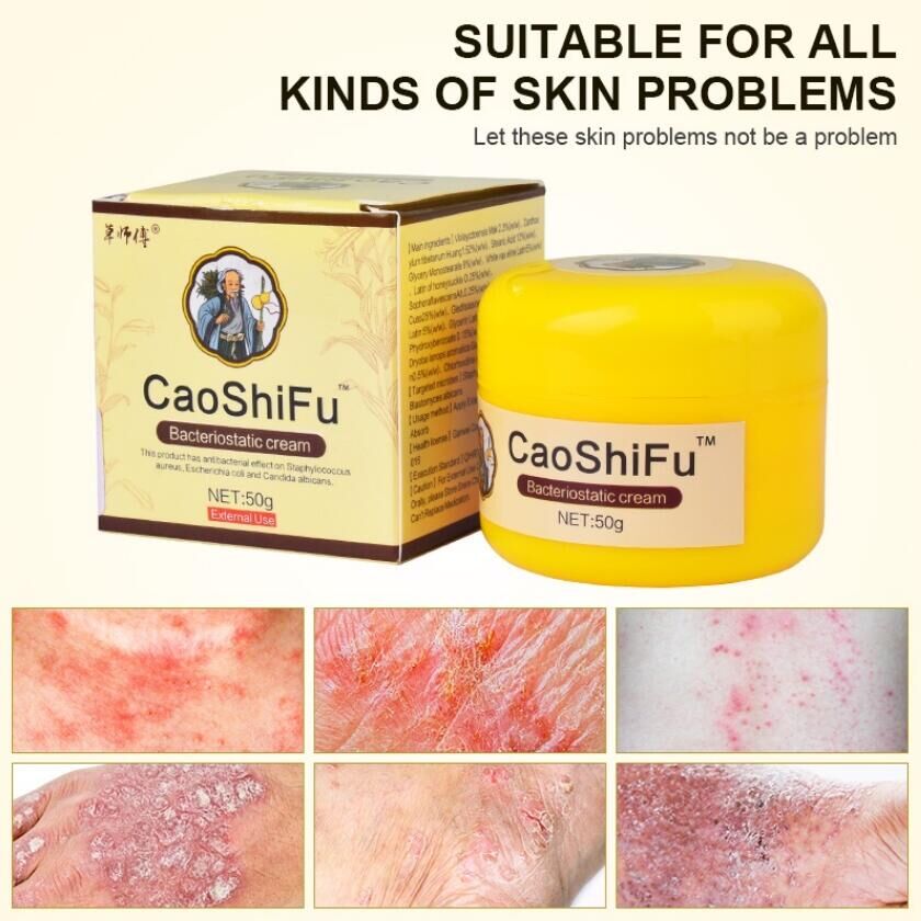 50g Caoshifu Eczema Psoriasis Treatment Ointment Antibacterial Cream Herbal Itching Skin Care 