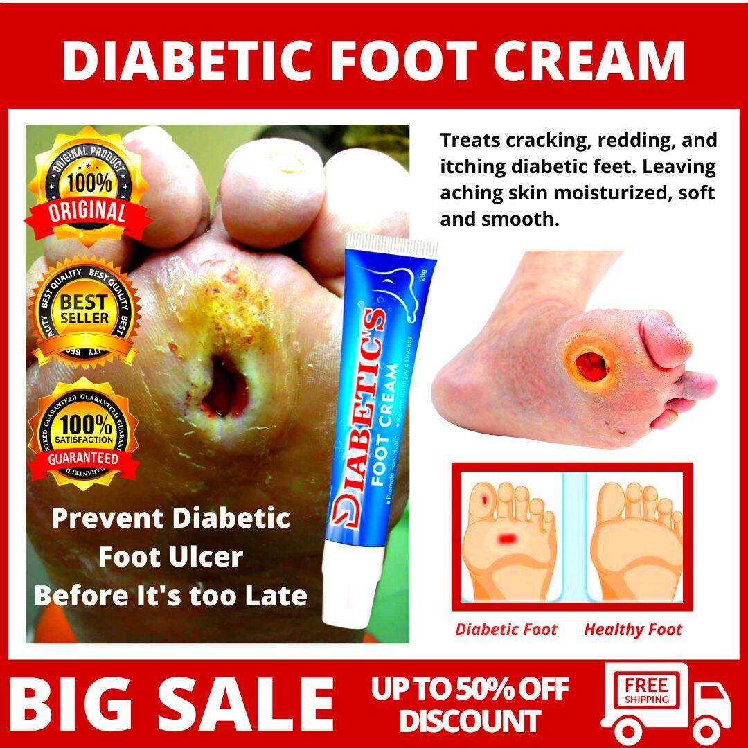 💯✅ORIGINAL【FLASH SALE】Guaranteed Effective DIABETIC FOOT Treatment CREAM  Foot Ulceration Cream Itch Relief Moisturizing Skin Care Antibacterial  Cream Anti Itch Moisturize Foot Skin Promotes Blood ...