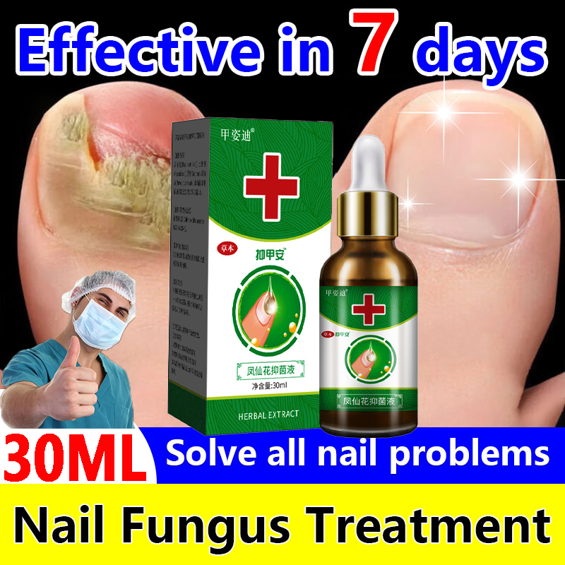 100 Effective fungal Nail treatment 20g Anti Paronychia Remove Onychomycosis Nail Fungus Repair