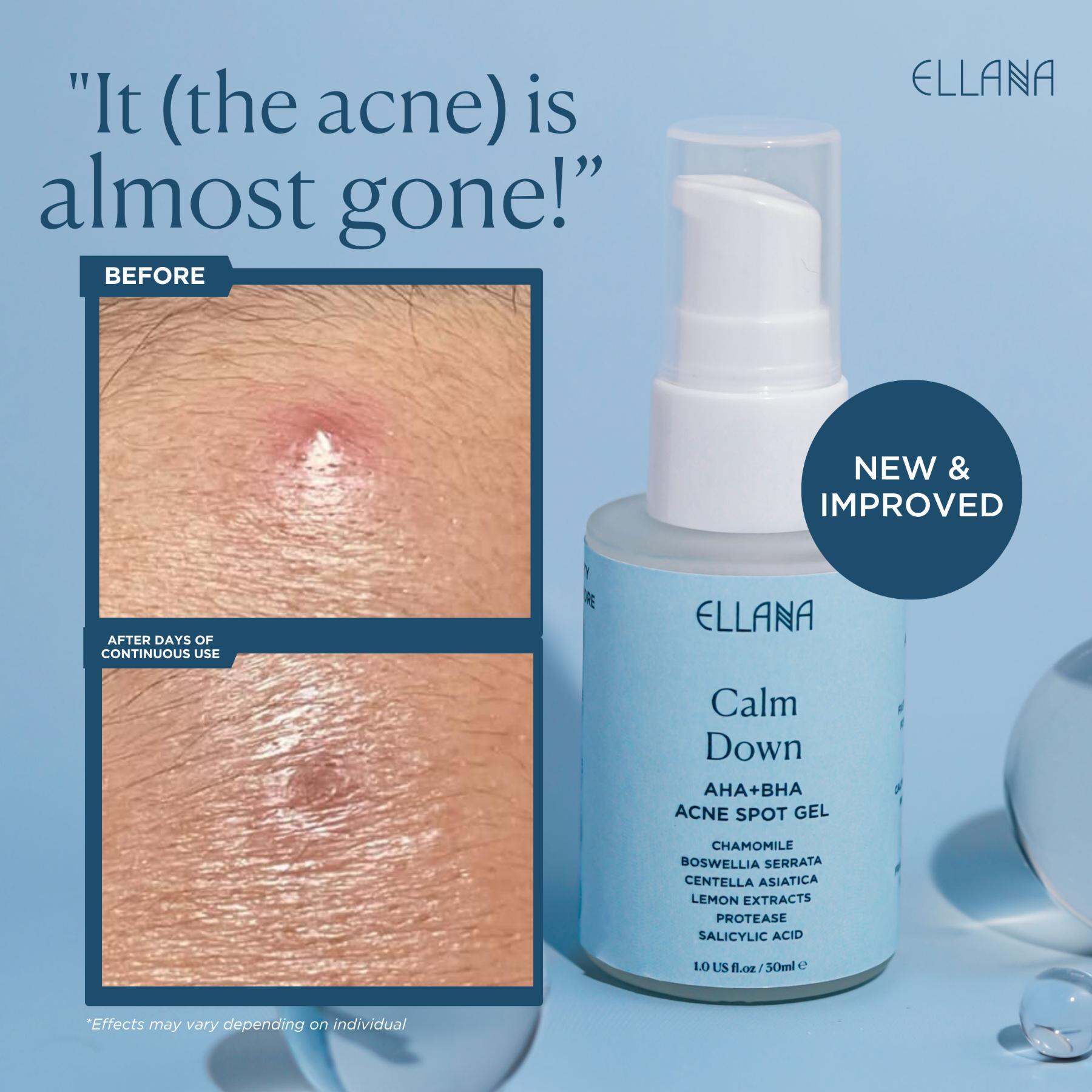 Ellana Calm Down Acne Spot Gel - 12g