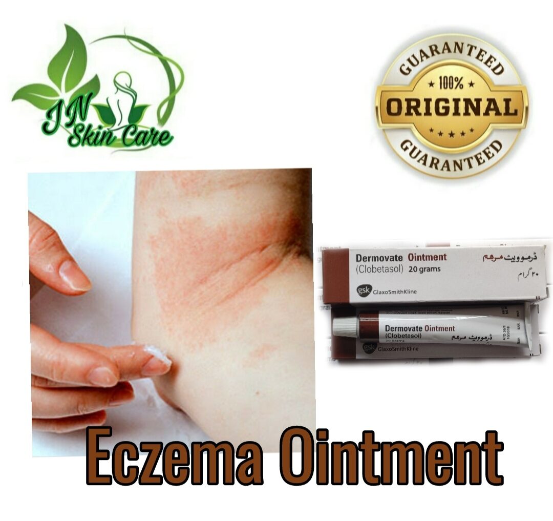 Original Dermovate Ointment for Eczema