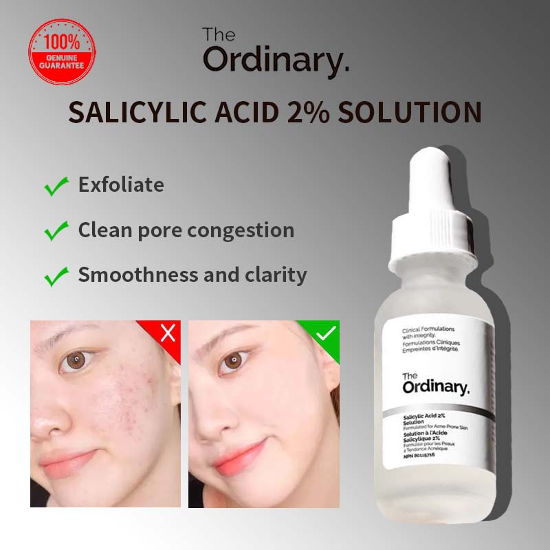 The Ordinary Salicylic Acid 2% Solution for Acne and Dark Spots