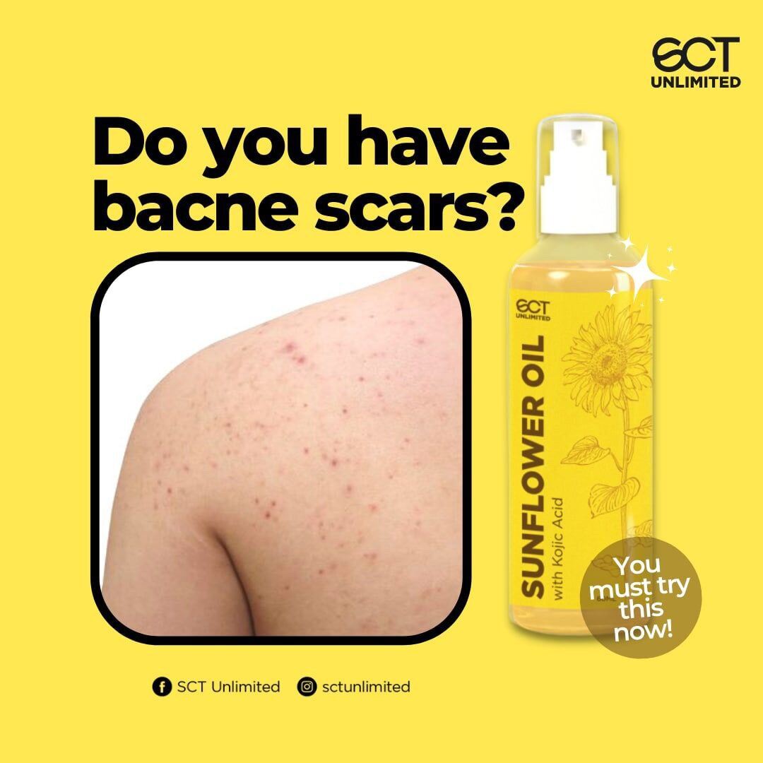 Sunflower Oil with Kojic Acid Lazada PH