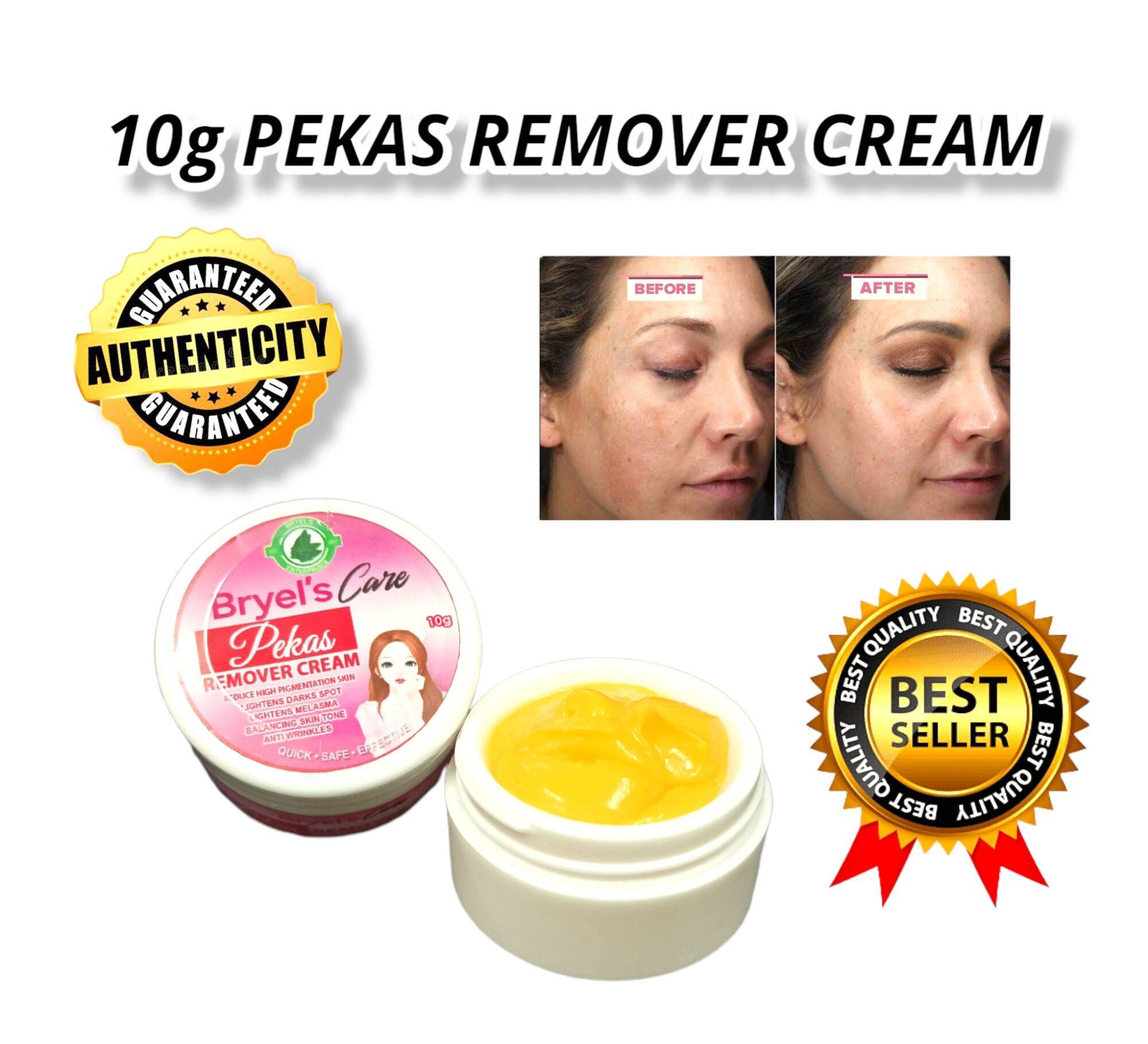 10g PEKAS ERASER/PEKAS REMOVER CREAM ORIGINAL/MELASMA REMOVER Lazada PH