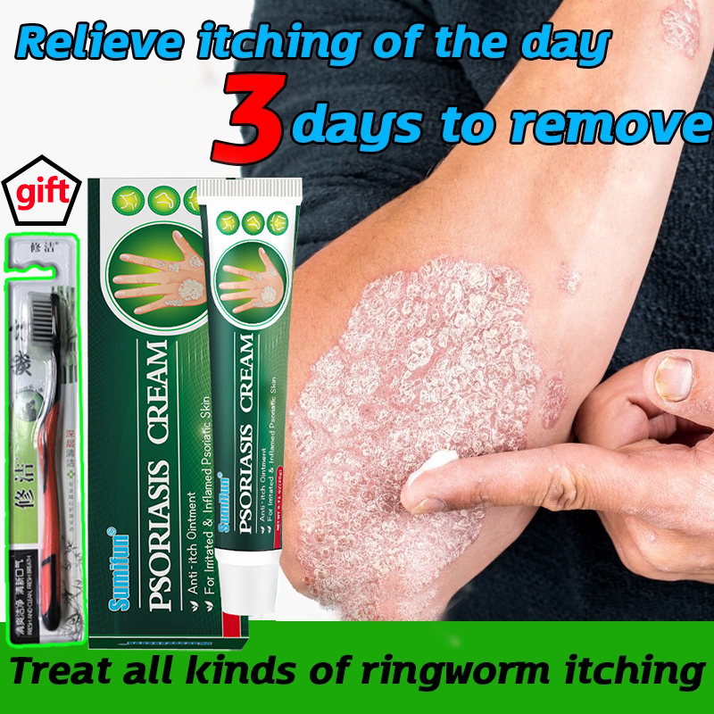 Psoriasis Remover Ointment 20g Quickly Relief Itching Herbal