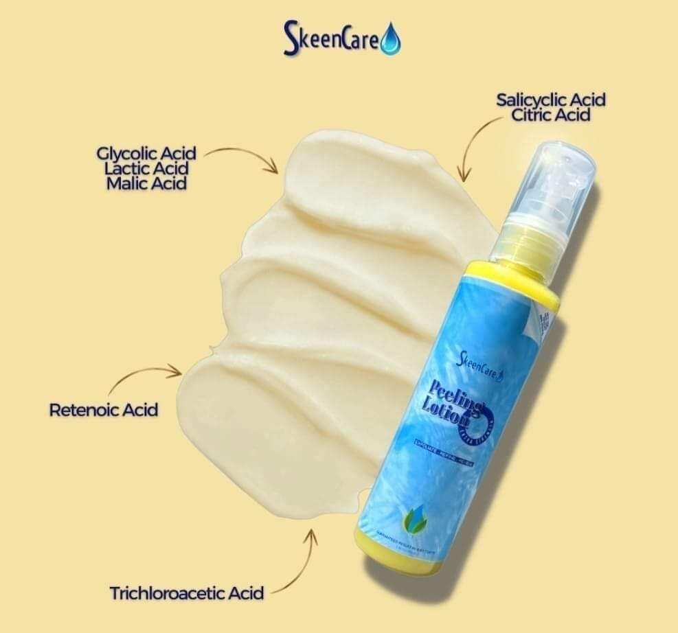 100ml Skeencare Peeling Lotion Extra Strength 101original Lazada Ph 6533